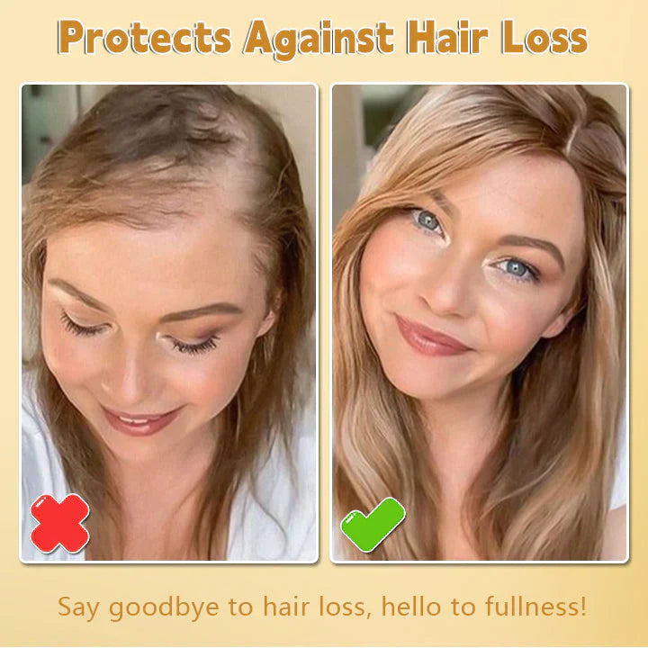 Biancat™ Biotin Hair Growth Essence Spray (BUY 1 GET 1 FREE)